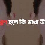 মুখে ব্রণ হলে কি মাখা উচিত acne