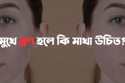 মুখে ব্রণ হলে কি মাখা উচিত acne